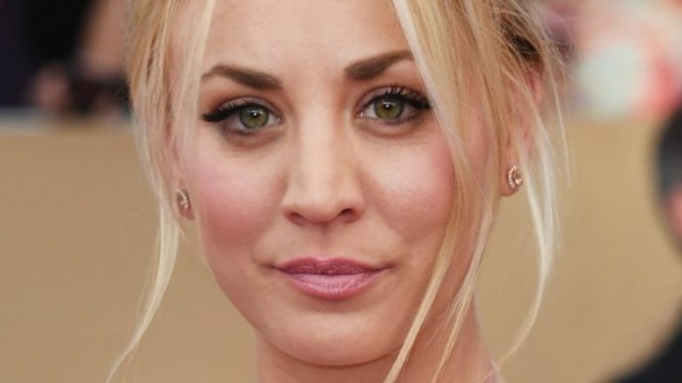 Kaley Cuoco opens up about post-wedding shoulder surgery - Wowplus.net