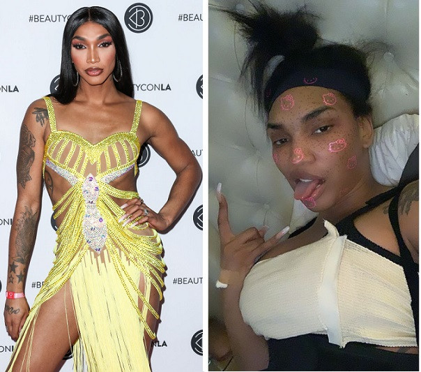 Kylie Jenner’s stylist Tokyo Stylez takes first step towards transitioning into a woman, undergoes Breast Augmentation (Photos)