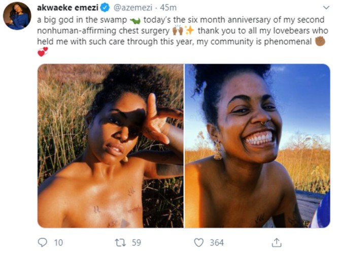 Popular Nigerian Writer, Akwaeke Emezi Goes T0pless, Reveals Chest After Br.east Removal Surgery