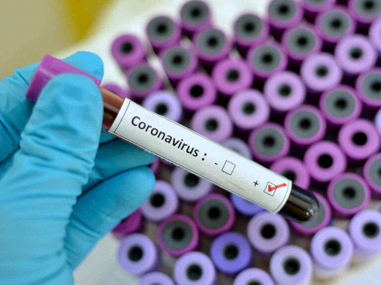 Nigeria news : Togo confirms first case of Coronavirus