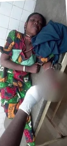 Nigerian Man Chops Off His Wife’s Hand For Disobeying Him picture