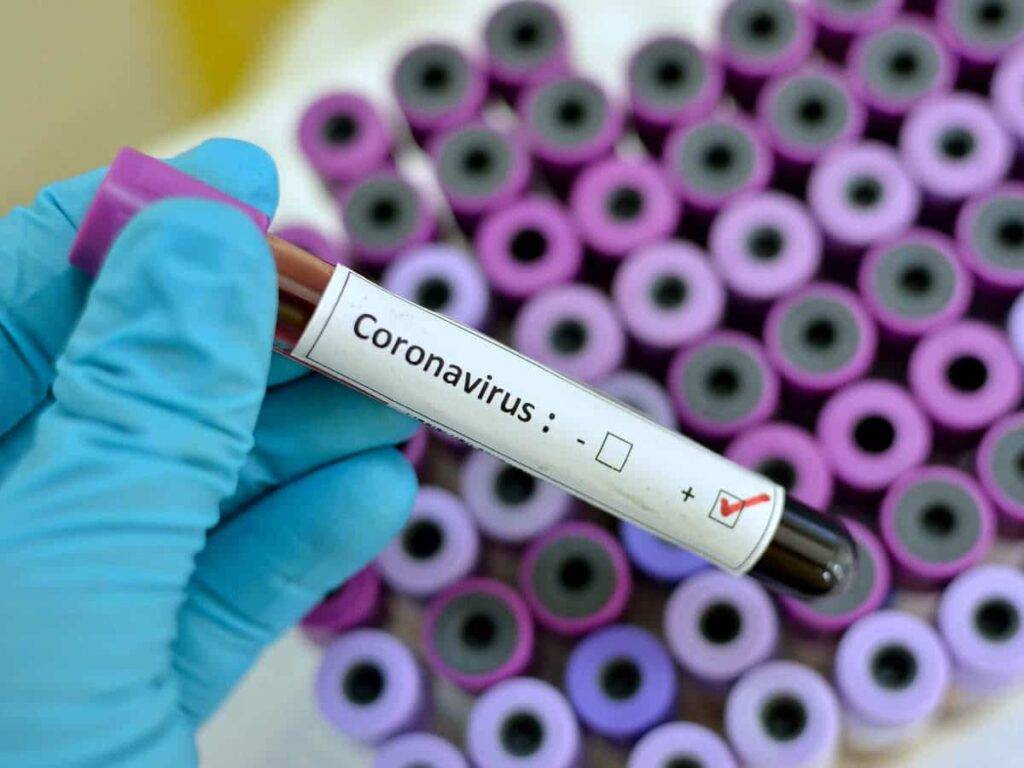 nigeria news breaking covid 19 lagos now has 74 active cases of coronavirus
