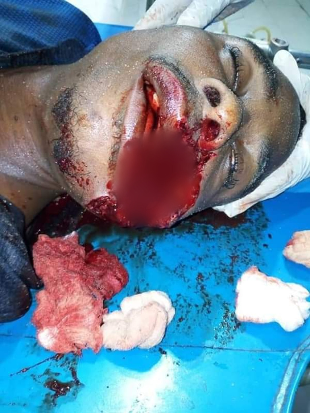 Cultists hack young man to death in Delta state (graphic photos)