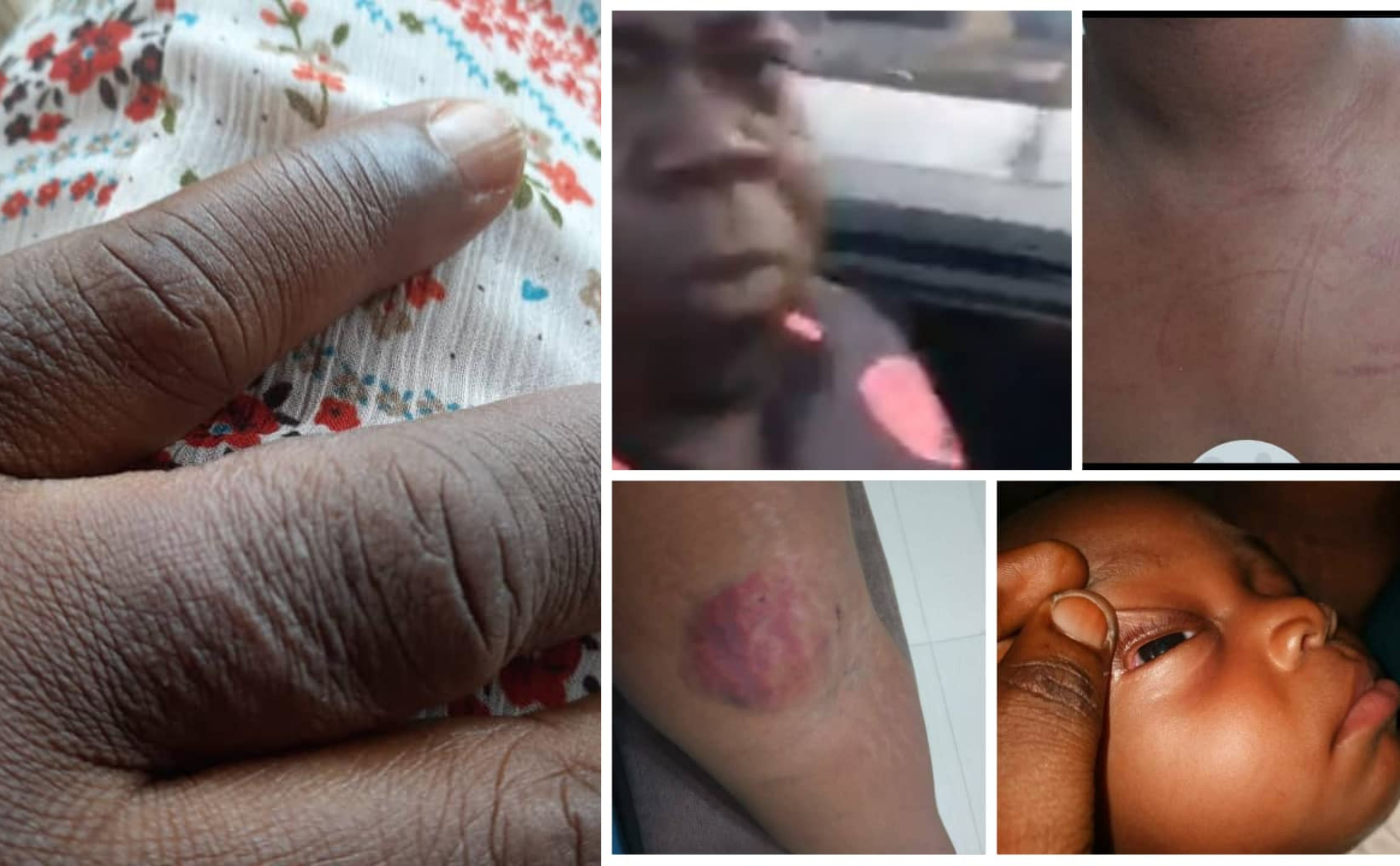 51-year-old woman counters nursing mother's claim of police officer assaulting her and her baby lindaikejisblog