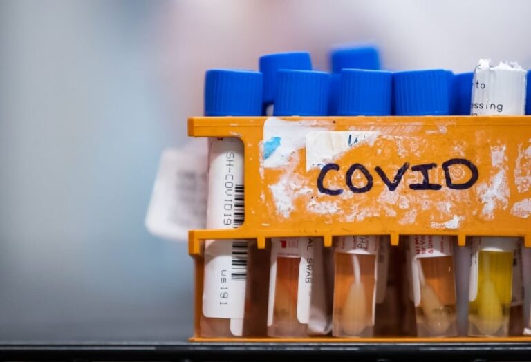 1st glimpse of Canada’s true COVID-19 infection rate expected mid-July from immunity testing