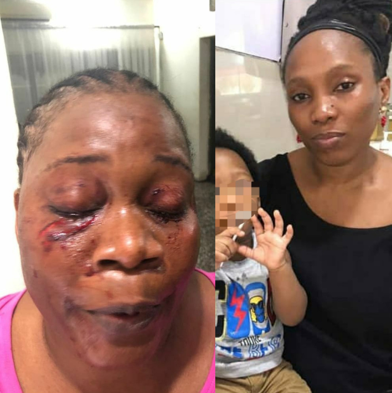 Woman allegedly disfigures her neighbour's face for reporting her actions in the compound to their lawyer