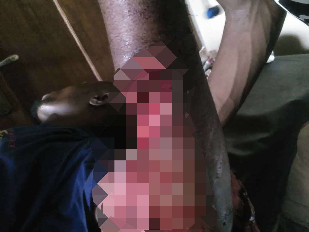 angry customer inflicts deep machete cut on electricity official in enugu graphic photo