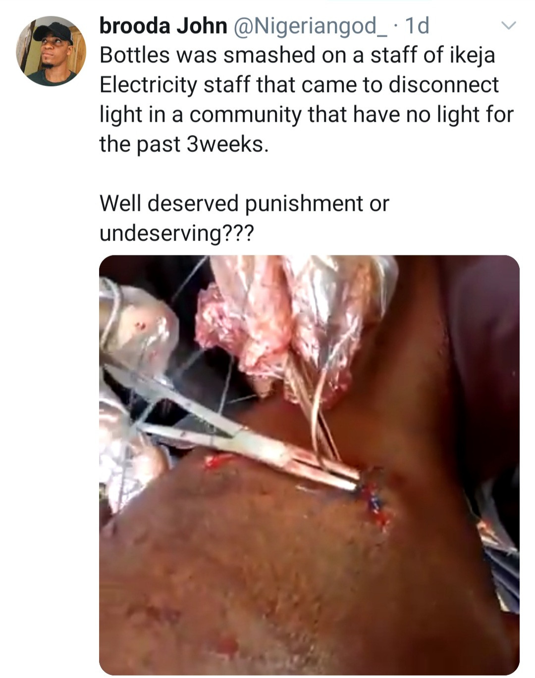IKEDC staff stabbed on the head with bottle when he tried to disconnect power from a community (video)