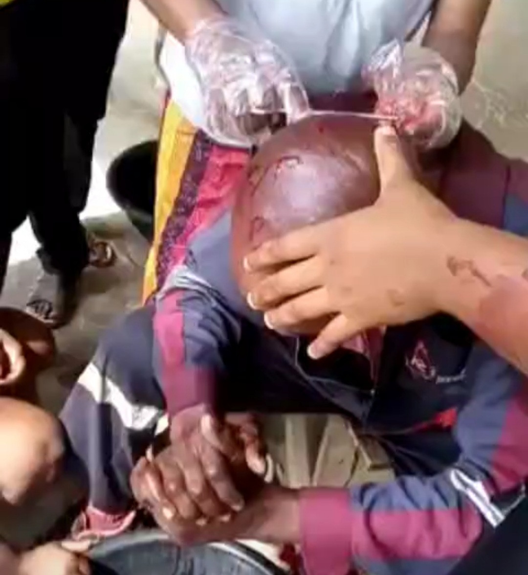 ikedc staff stabbed on the head with bottle when he tried to disconnect power from a community video
