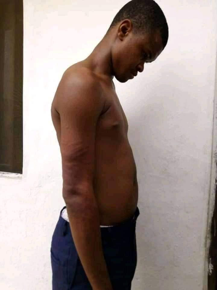nigerian man raises alarm after authorities of his former secondary school brutalized a student photos 1