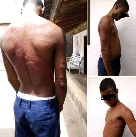 nigerian man raises alarm after authorities of his former secondary school brutalized a student photos