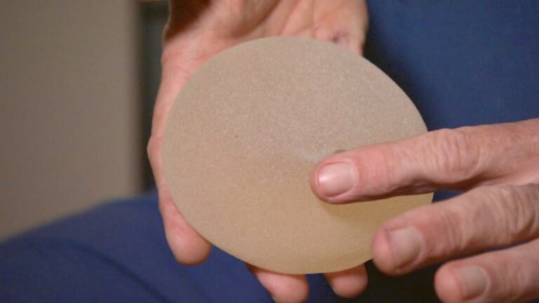 Woman who had breast implants removed urges Ottawa to mandate registry of medical devices