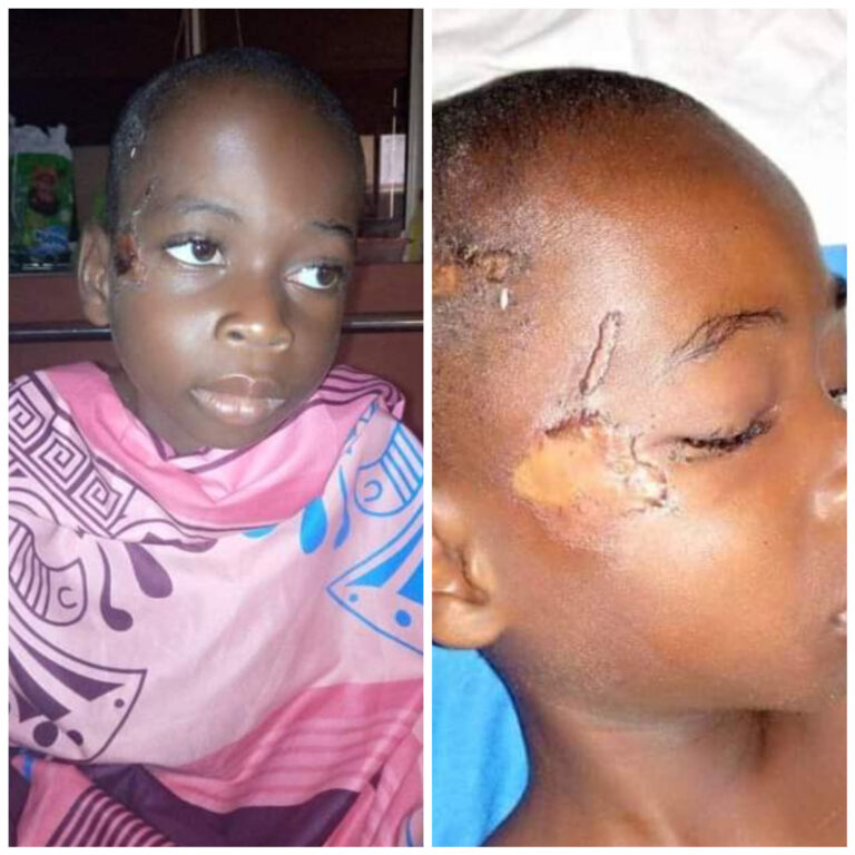 Little boy severely abused, beaten and left naked in bush in Akwa Ibom