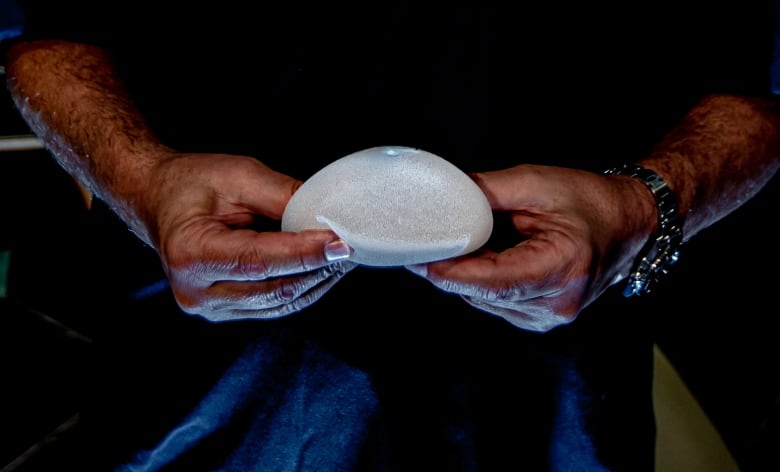 thousands of suspected injuries tied to breast implants revealed in manufacturer data dump cbc analysis finds 2