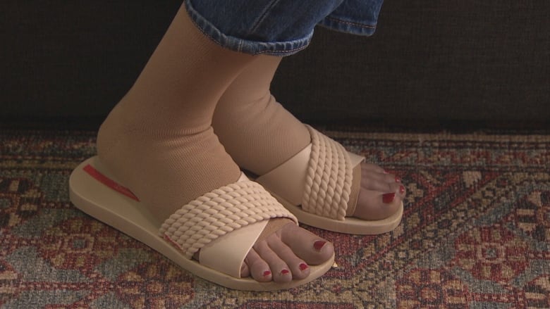 A woman's feet with compression stockings and sandals.