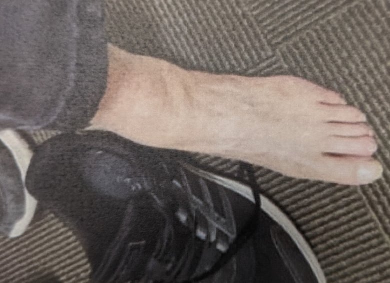 A person's left foot is pictured from the top, next to a black shoe.
