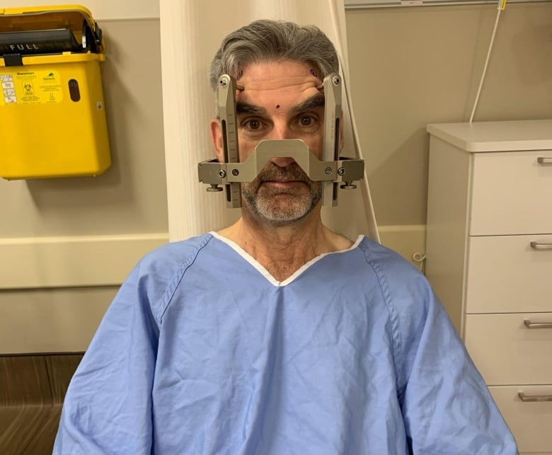 A man wearing a blue surgical smock sits and looks at the camera. His head is surrounded by a metal frame that will position his skull firmly in place. 