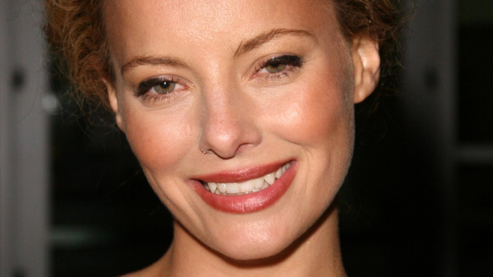 the serious kidney condition bijou phillips suffered with for years