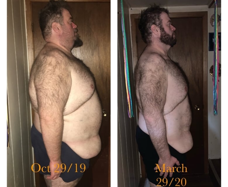 A before-and-after, side-view display of a man who lost a lot of weight. 