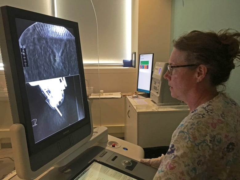 A health care profesional looks at images taken during a breast biopsy.