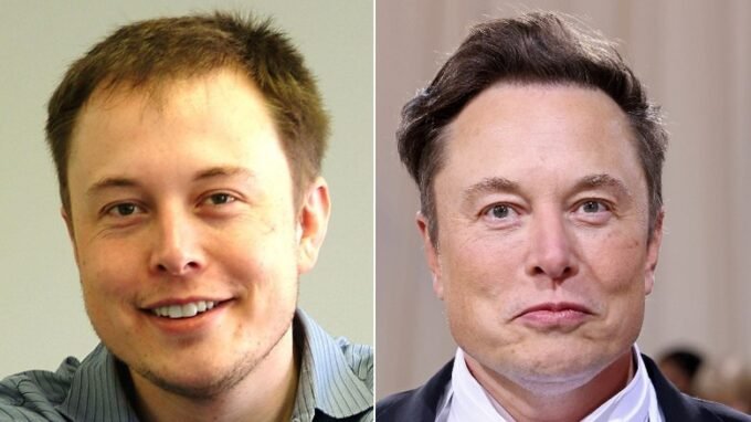 Throwback Pics Of Elon Musk Show Just How Bad His Hair Once Was