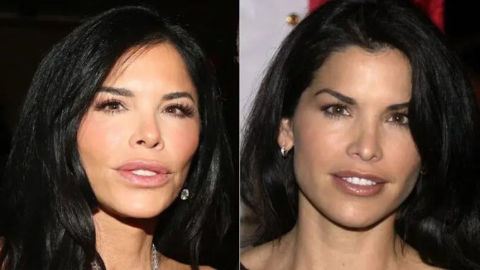Plastic Surgeon Tells Us The Secrets Behind Lauren Sanchez's Transformation