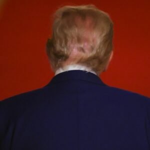 Trump's Hair Can't Hide Bald Spots Anymore & His Bright Scalp Is Nightmare-Worthy