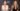 Is Sydney Sweeney Embracing The Mar-A-Lago Face Trend? Our Plastic Surgeon Spills