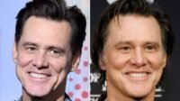 Before & After Pics Of Jim Carrey's Face Make His Tune-Ups Undeniable