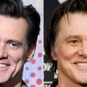 Before & After Pics Of Jim Carrey's Face Make His Tune-Ups Undeniable
