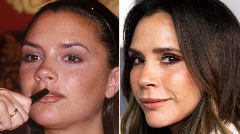 Before And After Pics Of Victoria Beckham Hint Those Plastic Surgery Rumors Aren't BS