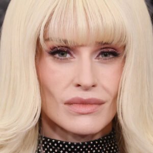 12 Jarring Images Of The Celebrity Ozempic Face Tragedy