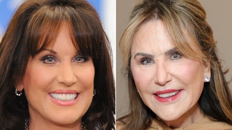 Dr. Phil's Wife Robin's Most Obvious Face Tune-Ups, According To A Plastic Surgeon