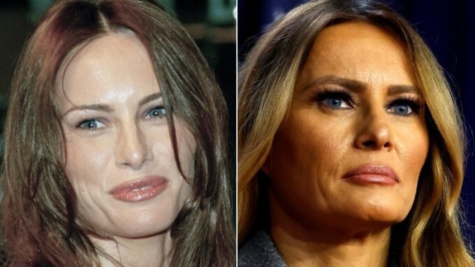 Photos Highlight How Melania Trump’s Facial Features Have Changed Over the Years 6 Side-By-Side Pics Of Melania Trump Highlight How Chiseled Her Face Has Become