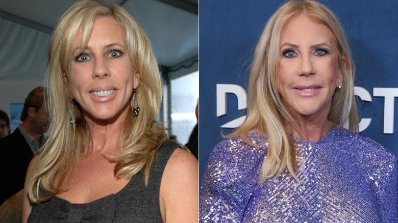 Side-by-side images of Vicki Gunvalson posing for a photo