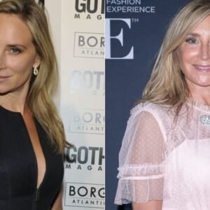 What These Real Housewives Looked Like Before And After Plastic Surgery