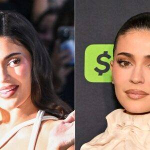 12 Celebs Who Dissolved Their Filler And Look Way Better For It