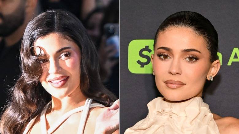 12 Celebs Who Dissolved Their Filler And Look Way Better For It