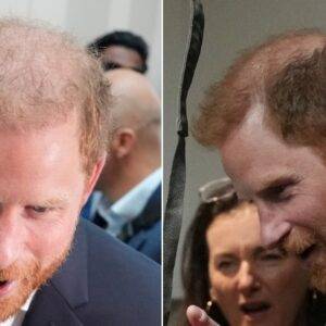 Prince Harry's Wicked Bald Patch Finds No Place To Hide In Australia As Cameras Capture Every Angle