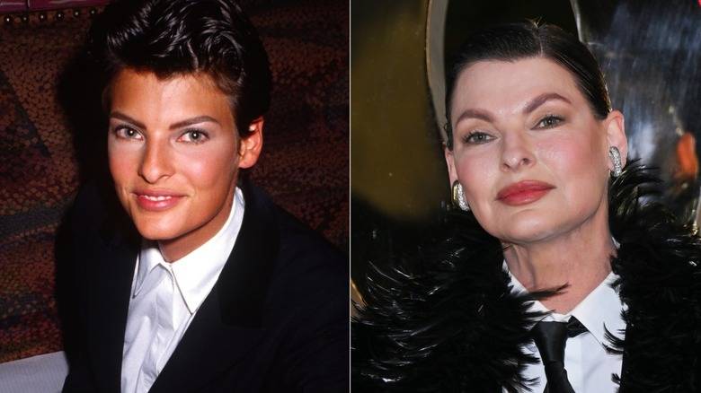 Supermodels With Jarring Plastic Surgery Transformations That Shocked Fans 138 Linda Evangelista in a split, before-and-after picture
