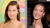 Supermodels With Jarring Plastic Surgery Transformations