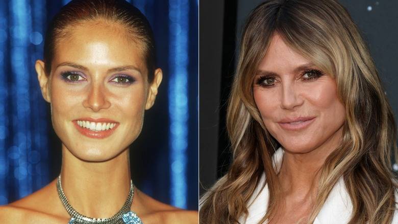 Supermodels With Jarring Plastic Surgery Transformations That Shocked Fans 141 A before-and-after picture of Heidi Klum in the '90s and 2020s.