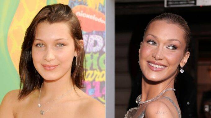 Supermodels With Jarring Plastic Surgery Transformations