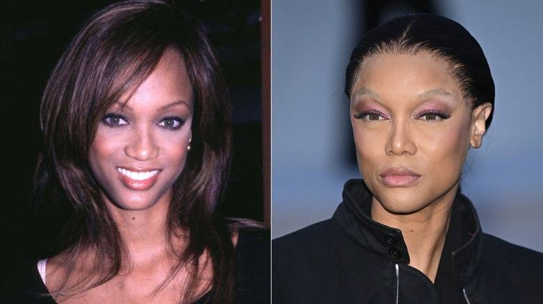 Supermodels With Jarring Plastic Surgery Transformations That Shocked Fans 143 Model Tyra Banks in a split image