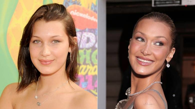 Supermodels With Jarring Plastic Surgery Transformations