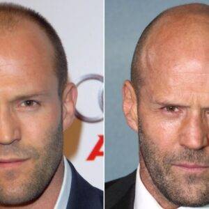 Before & After Pics Capture Jason Statham's Hair Transformation