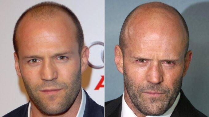 Before & After Pics Capture Jason Statham's Hair Transformation